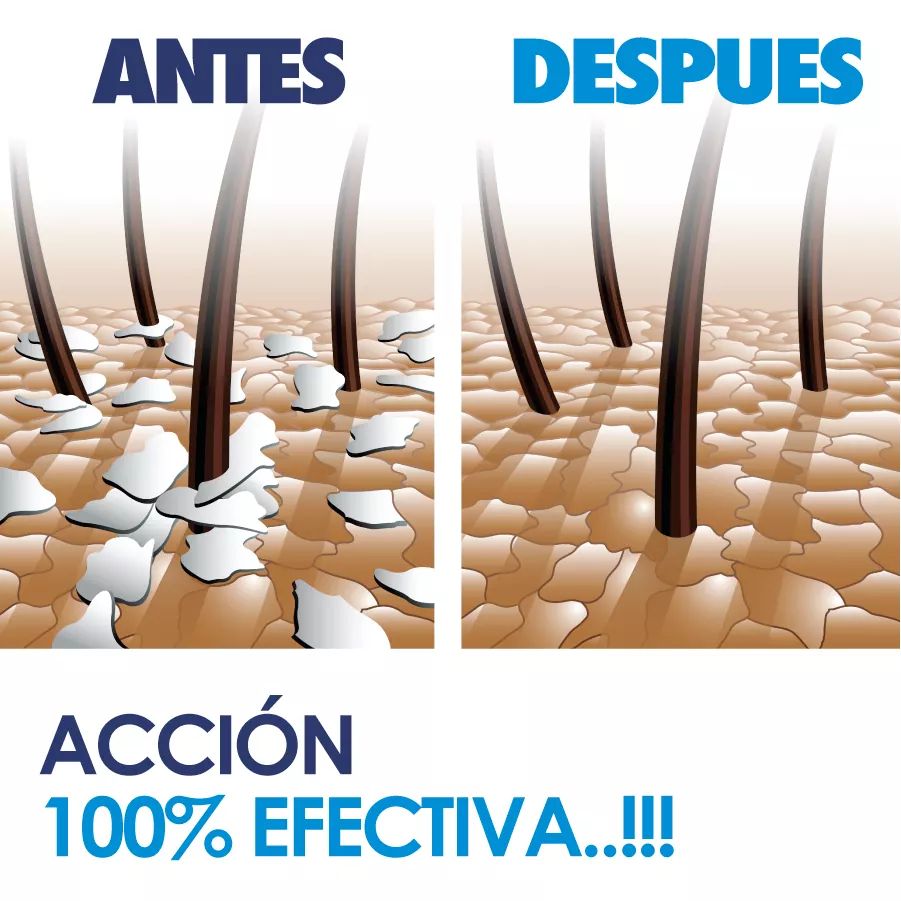 ACONDICIONADOR DE PLATA COLOIDAL ROMERO 500ML